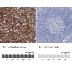 Plasmolipin Antibody, Novus Biologicals 0.1mL; Unlabeled:Antibodies, Polyclonal